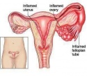 vaginal herbs call/ whatsapp dr ezra deko on +27 71 009 6483 - product's photo